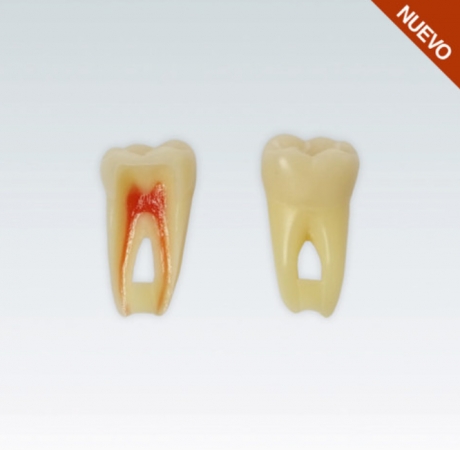 MOLAR INFERIOR CON PULPA ANA - 4Z3RN-36. NO CAMBIO NI DEVOLUCIÓN