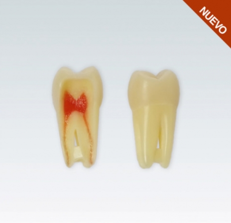 MOLAR SUPERIOR CON PULPA ANA - 4Z3RN-16. NO CAMBIO NI DEVOLUCIÓN
