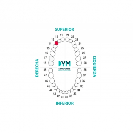 DIENTE Nº13 CANINO SUP.DER. 1U