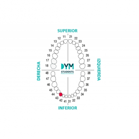 DIENTE Nº43 CANINO INF.DER. 1U