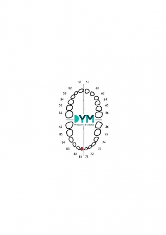 DIENTE Nº81 INCISIVO CENTRAL INF.DER 1U