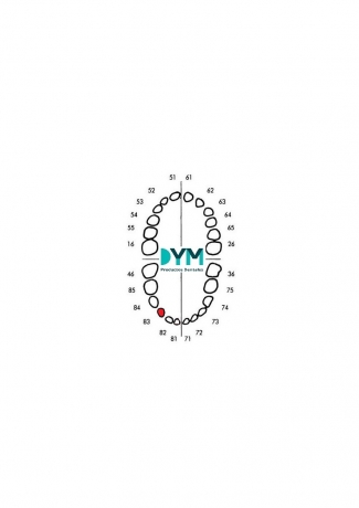 DIENTE Nº83 CANINO INF.DER 1U