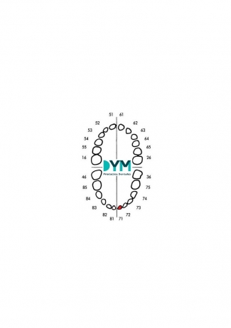 DIENTE Nº71 INCISIVO CENTRAL INF.IZQ 1U