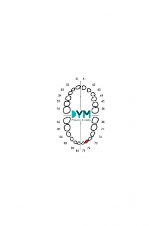 DIENTE Nº72 INCISIVO LATERAL INF.IZQ 1U