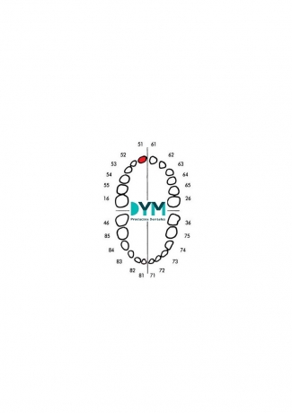 DIENTE Nº51 INCISIVO CENTRAL SUP.DER 1U