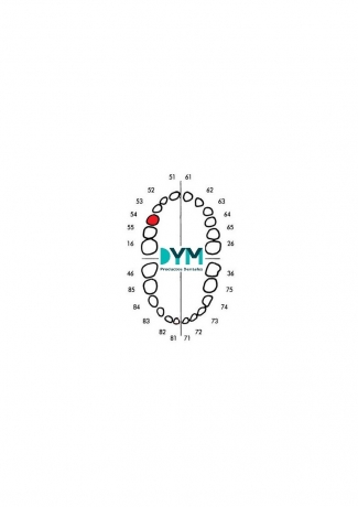 54 FIRST MOLAR UPPER TEETH RIGHT PART 1U