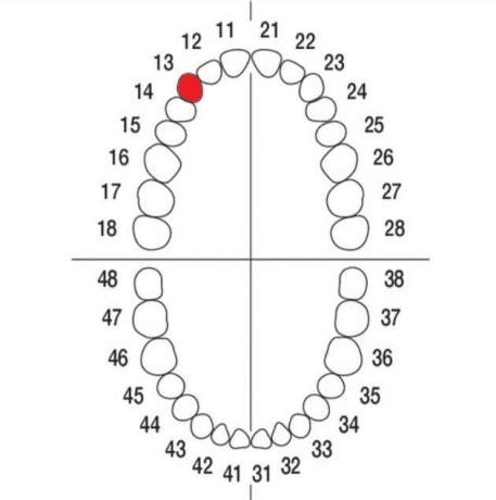 DIENTE Nº13 MODELO A3