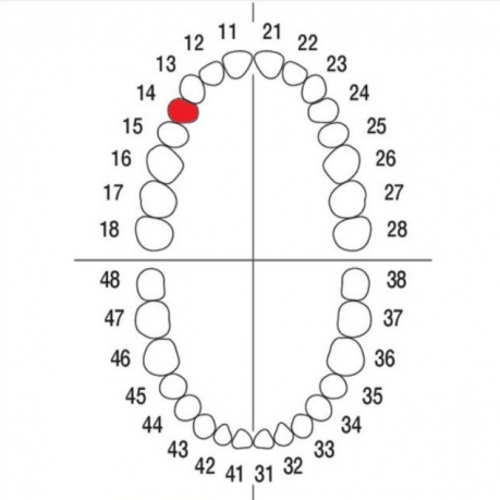 DIENTE Nº14 MODELO A3