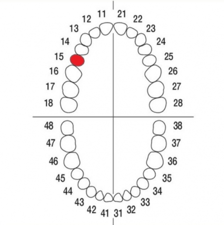 DIENTE Nº15 MODELO A3