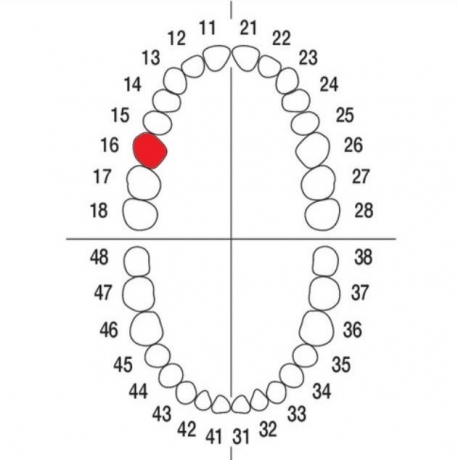 DIENTE Nº16 MODELO A3