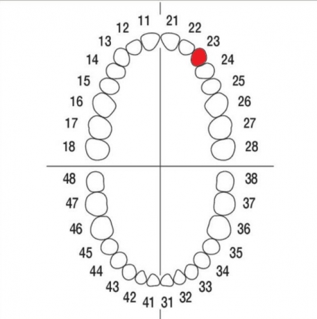 DIENTE Nº23 MODELO A3
