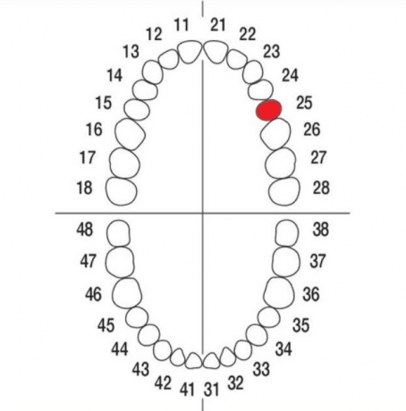 DIENTE Nº25 MODELO A3