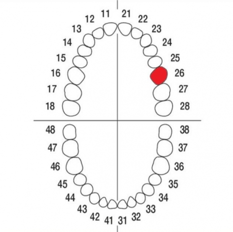 DIENTE Nº26 MODELO A3