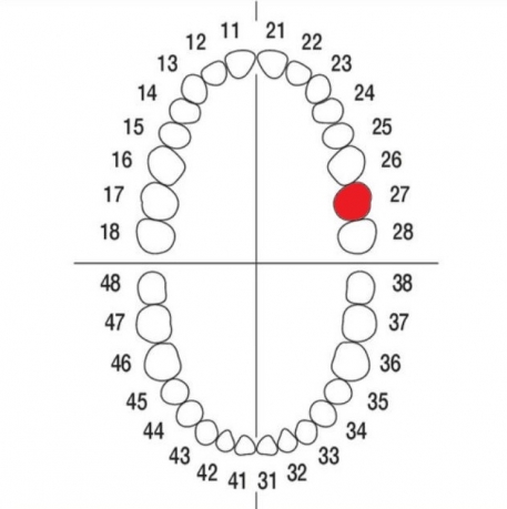 DIENTE Nº27 MODELO A3