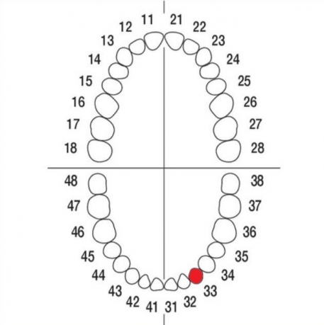 DIENTE Nº33 MODELO A3