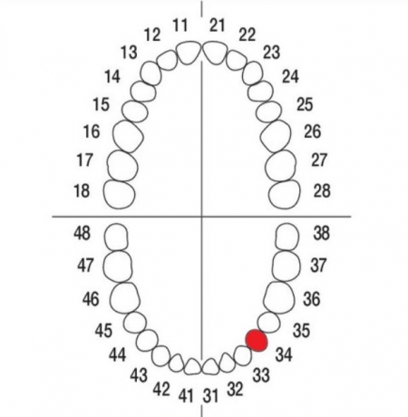 DIENTE Nº34 MODELO A3