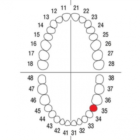 DIENTE Nº35 MODELO A3
