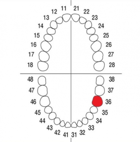 DIENTE Nº36 MODELO A3
