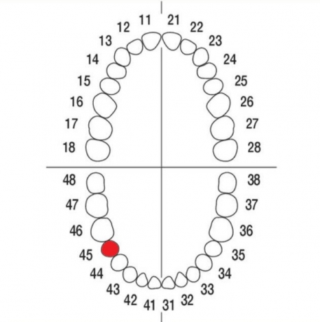 DIENTE Nº45 MODELO A3